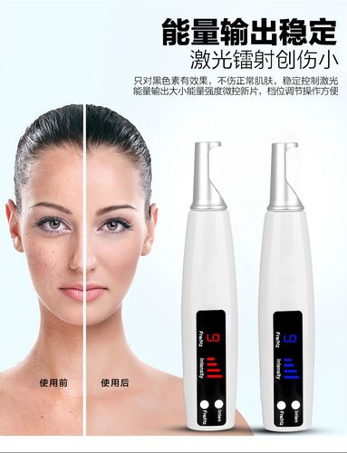 皮秒笔激光洗眉黑色素点痣家用小型便携式美容仪器 插电款红光(无麻膏